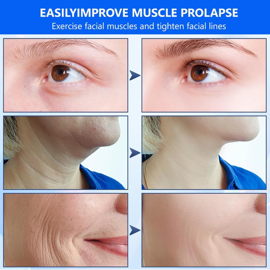 Tiras de lifting facial