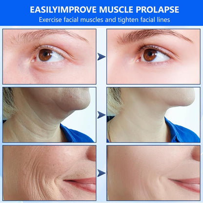 Tiras de lifting facial